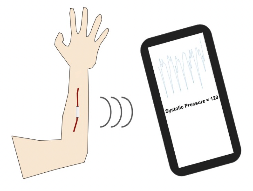 Blood pressure flow sensor Blood pressure flow sensor